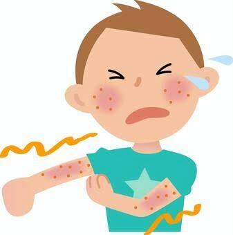 アトピー性皮膚炎の悩み解決します ステロイドは使いません！身近なもので楽になります イメージ1