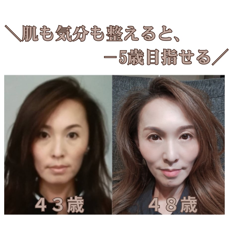 肌と気分が整うと、見た目が5歳若返ります 元美容部員×分子栄養アドバイザーによる肌根本分析 イメージ2