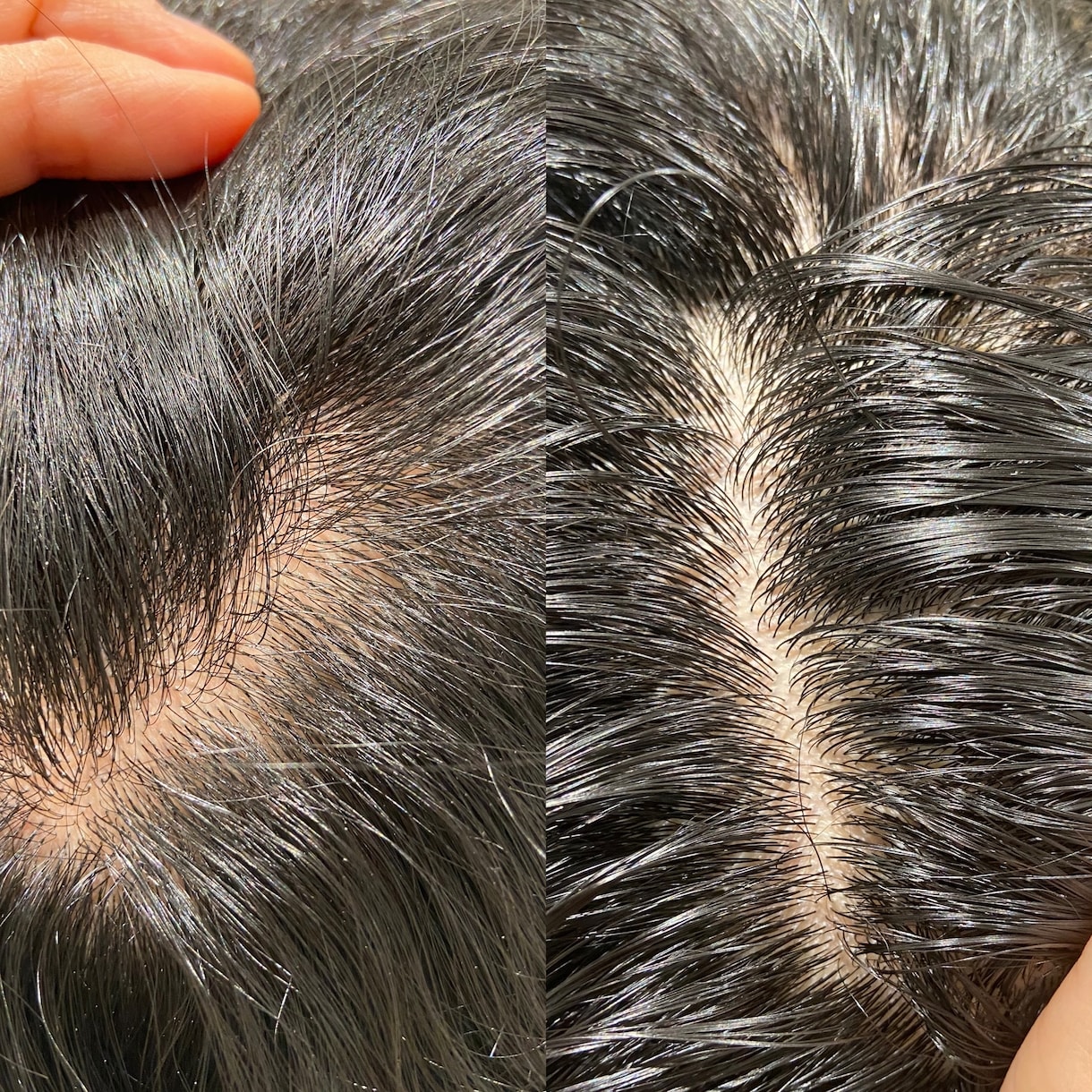 お金と時間をかけず白髪を無くす方法お伝えします 【37歳白髪なし】スパニストが実際にやってる頭皮マッサージ！ イメージ3