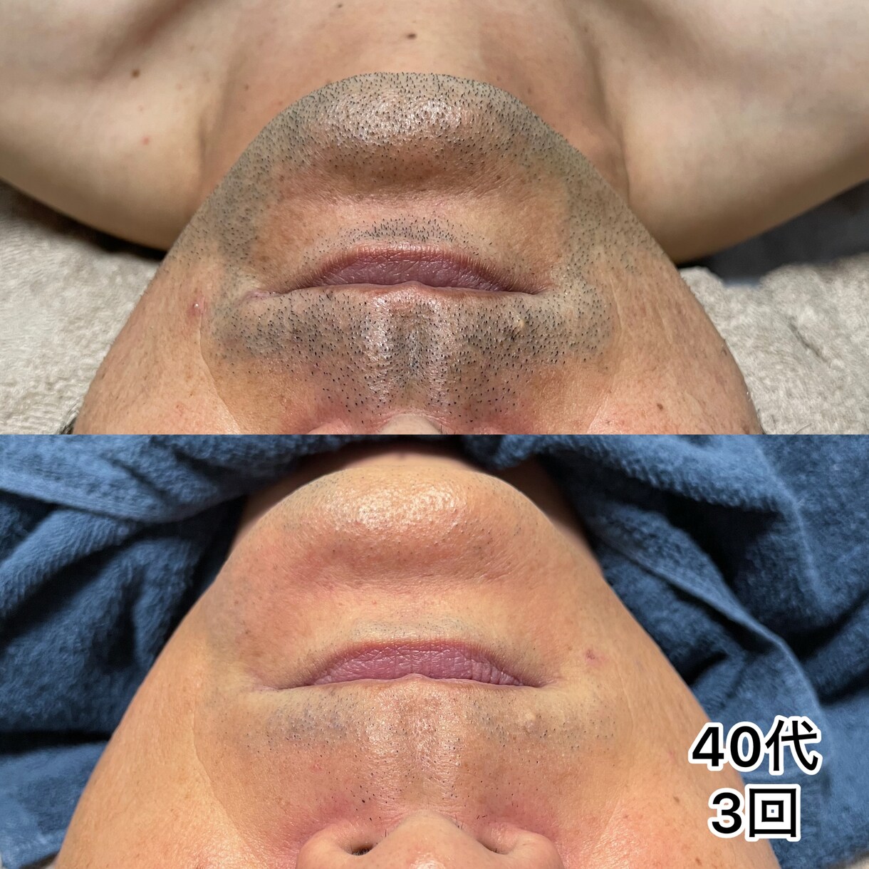 ヒゲ脱毛で結果を出せてないオーナー様救います 効果が出ない原因を徹底改善！1ヶ月で別人にできるサロンへ。 イメージ2