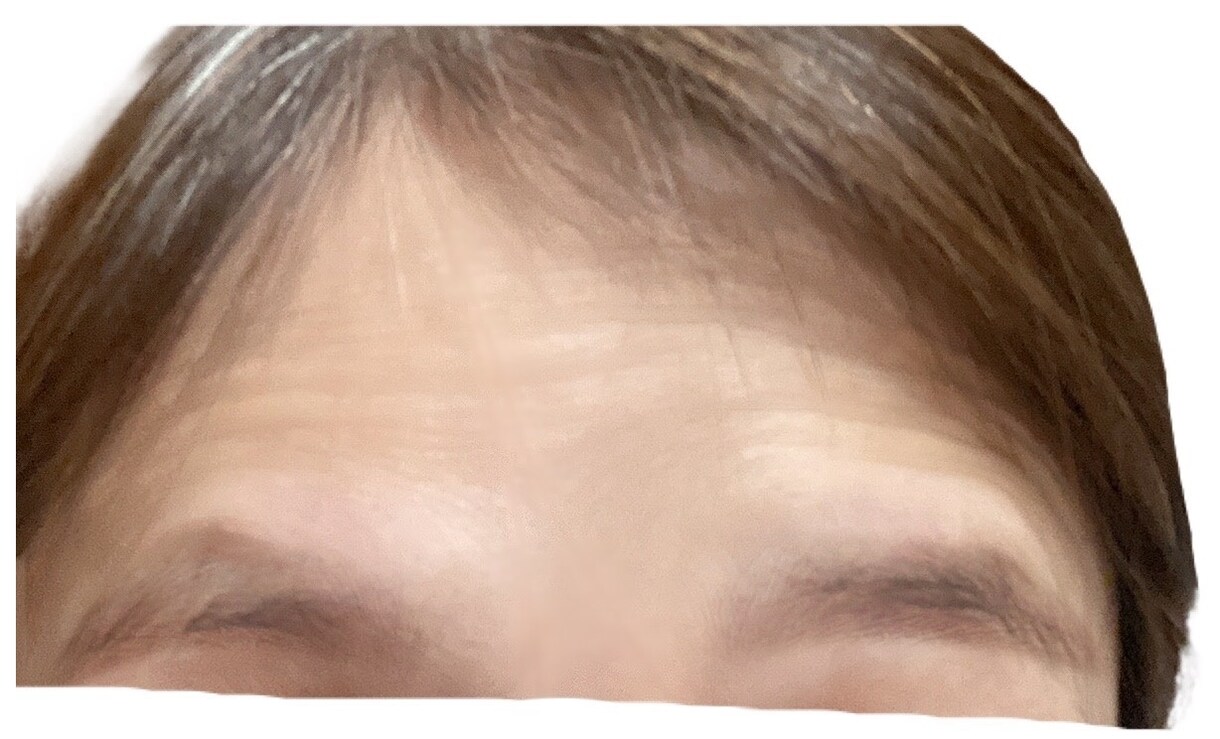 シワとたるみが10日で劇的に改善した裏技を教えます シワとたるみ、もう諦めない！まだ間に合う簡単な方法で美肌へ！ イメージ3