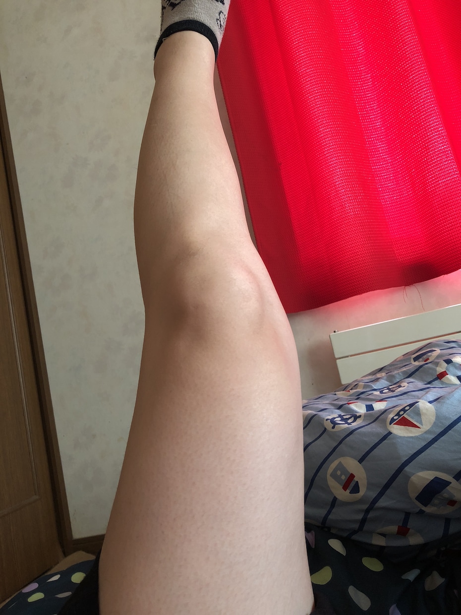 永久脱毛は自宅で出来ます 剛毛な毛も今では さっぱりなくなりました イメージ1