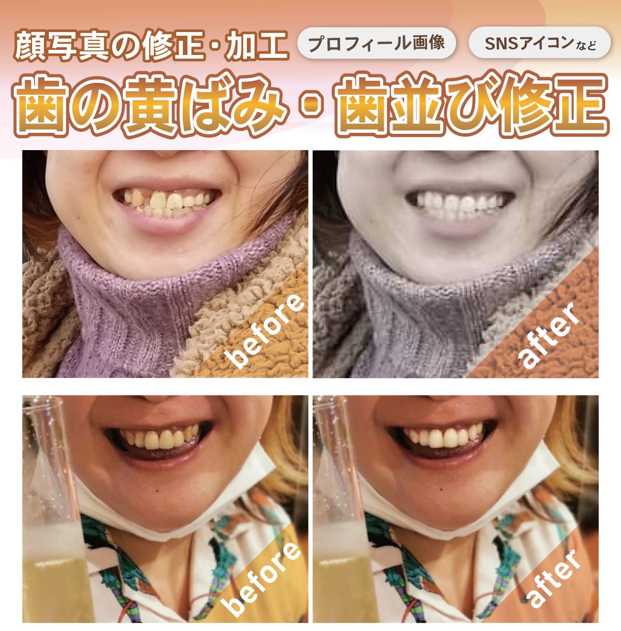 歯並び黄ばみの補正で好印象な笑顔画像に仕上げます まずはご相談ください！丁寧な対応心がけます イメージ1