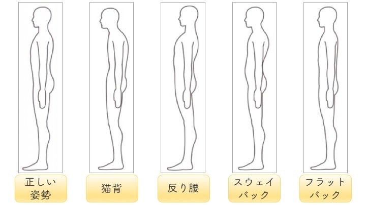 特別価格！写真2枚で姿勢診断＆改善提案します 誰にでもわかりやすく現役ピラティスインストラクターが診断。 イメージ4