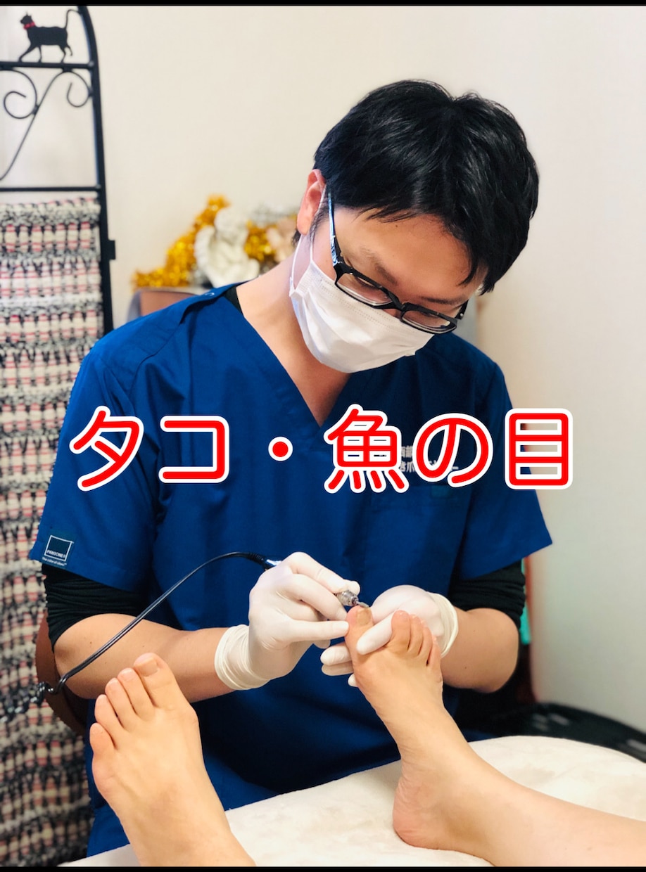 💬Coconara｜Currently accepting reservations A proven professional will speak to those who are worried about corns.Ingrown nail foot meister...
