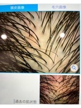 あなたに合ったヘアケアの方法お伝えします 毛髪診断士等の観点からお悩みに関するアドバイスを致します イメージ1