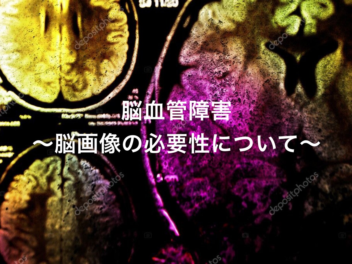 リハビリの勉強資料をパワーポイントで提供します 脳画像、被殻のアプローチ、発達などなど イメージ1