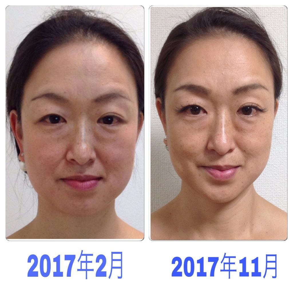 小顔セルフケアレッスンします 小顔美整体セラピスト直伝！日々のケア次第で貴方は変わります イメージ1