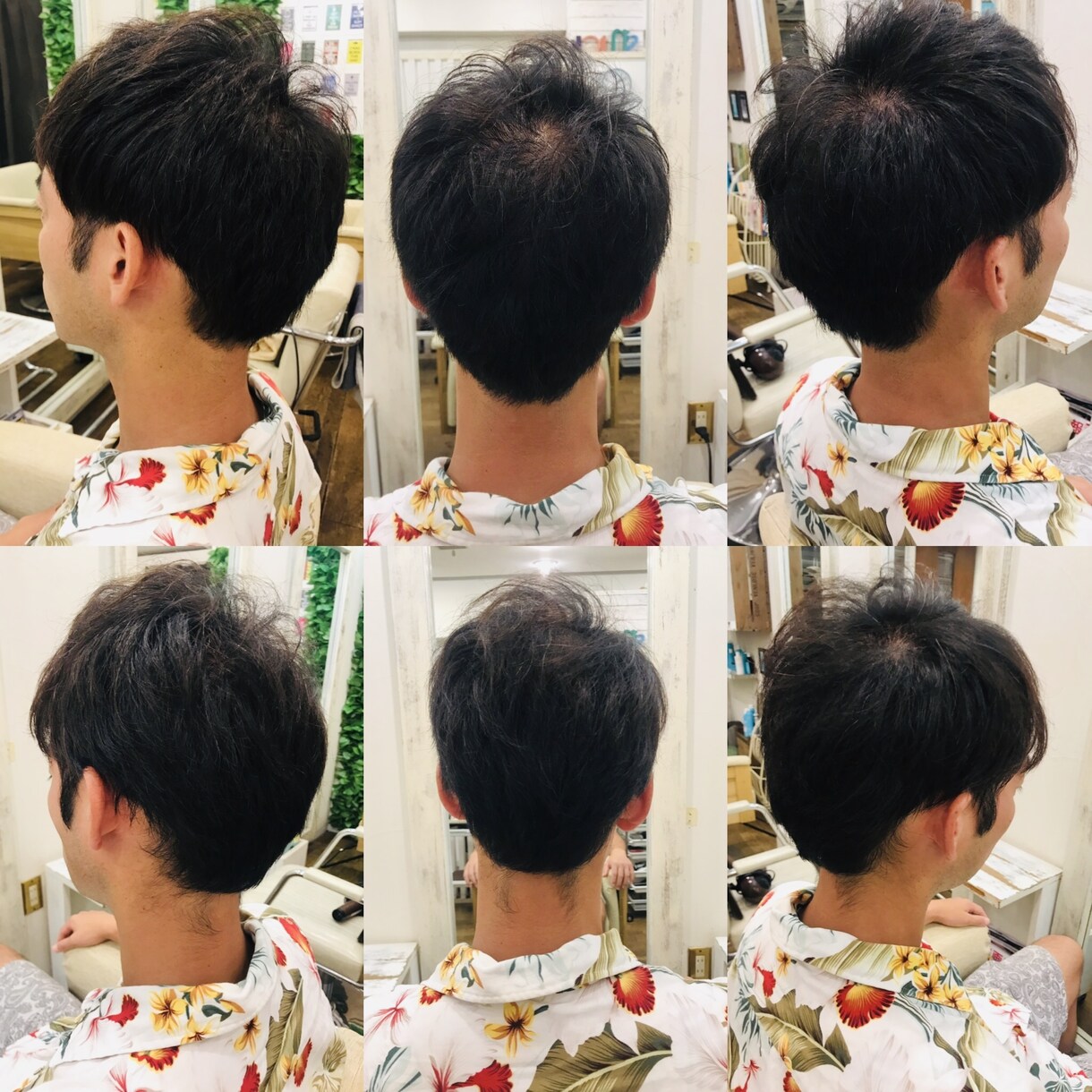 現役美容師が髪の洗い方をしっかり伝授します 抜け毛薄毛予防！健康な髪を生やすことが大事！ イメージ1