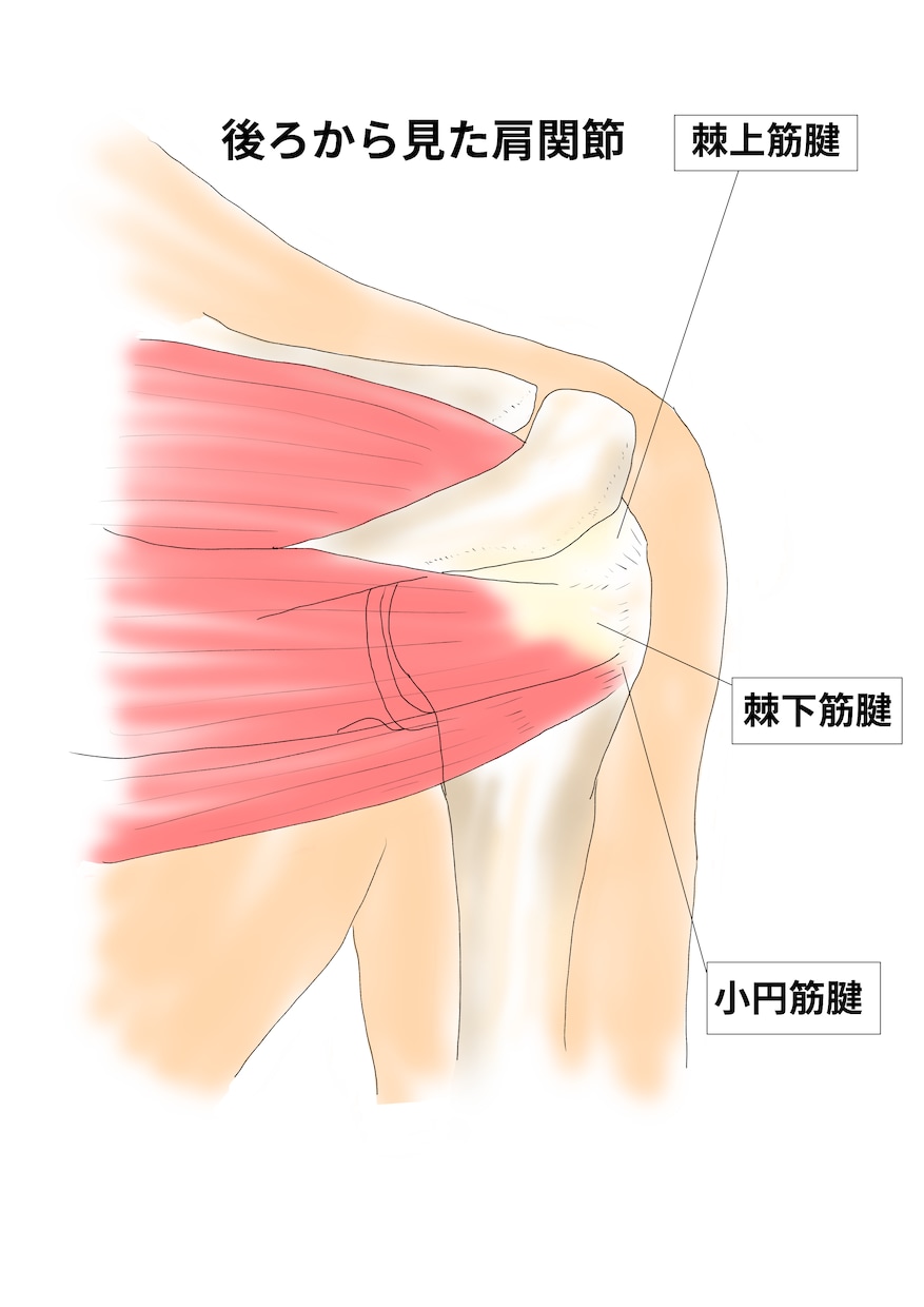 整形外科専門医が医療イラストを描きます 論文用シェーマや患者説明用イラストなどに！ イメージ5
