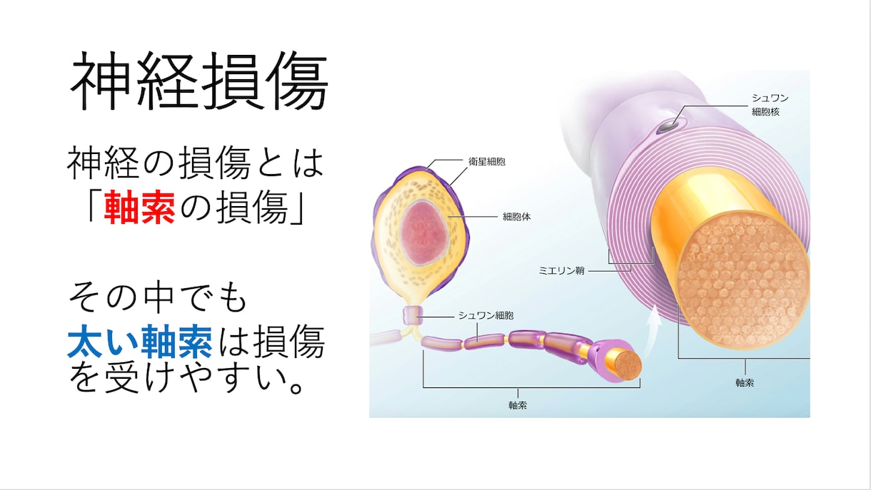 多くの方が悩んでいる神経痛に関してお伝えします 痺れる・だるい・力が入らない、それだけが神経痛ではない！ イメージ3