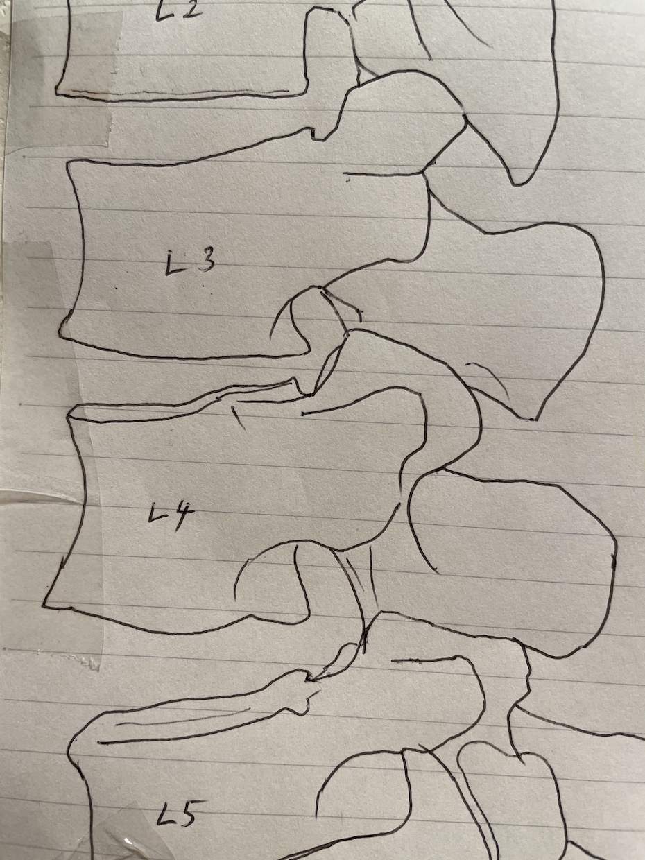 整形外科フリー素材提供します 骨,筋,靭帯描きます(脈管系も承ります) イメージ3
