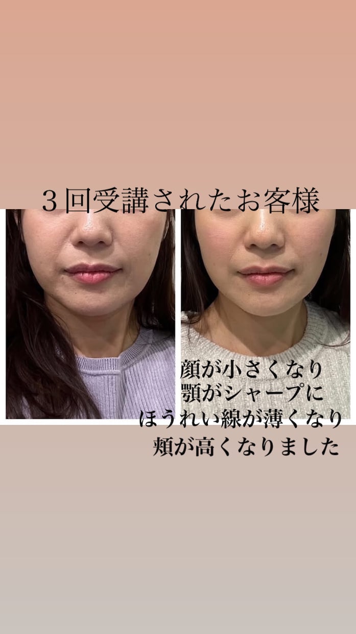 顔ヨガで小顔、リフトアップになる方法を教えます １００名以上の実績あり、効果を感じて頂いています イメージ5