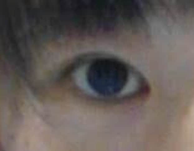 あなたの瞼にぴったりの二重にする方法を教えます テープか、のりか…どの方法がいいの？写真で診断できます！ イメージ2