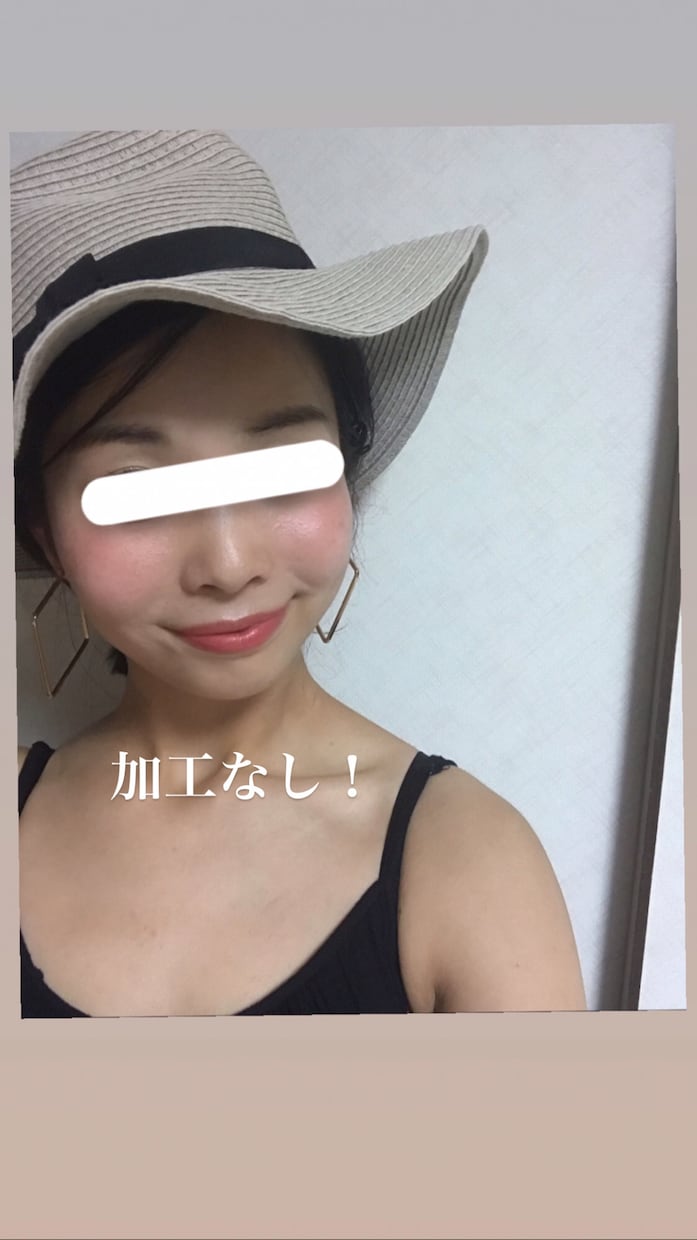 お肌の弱い方へアドバイス致します ファンデに頼らず乾燥・アトピー肌でくすんでいた肌が蘇る！ イメージ1