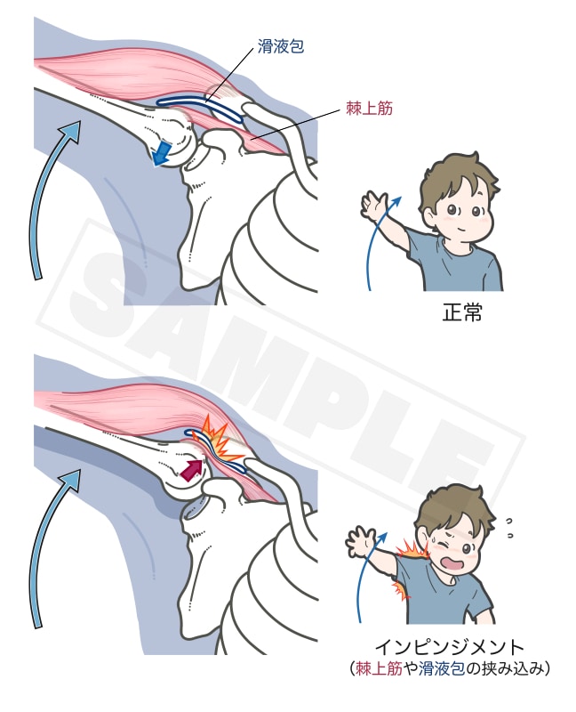 医療・看護・教材イラスト ポップな絵柄で制作します 健康フィットネス系、筋肉・骨格・臓器、医療器具etc… イメージ2
