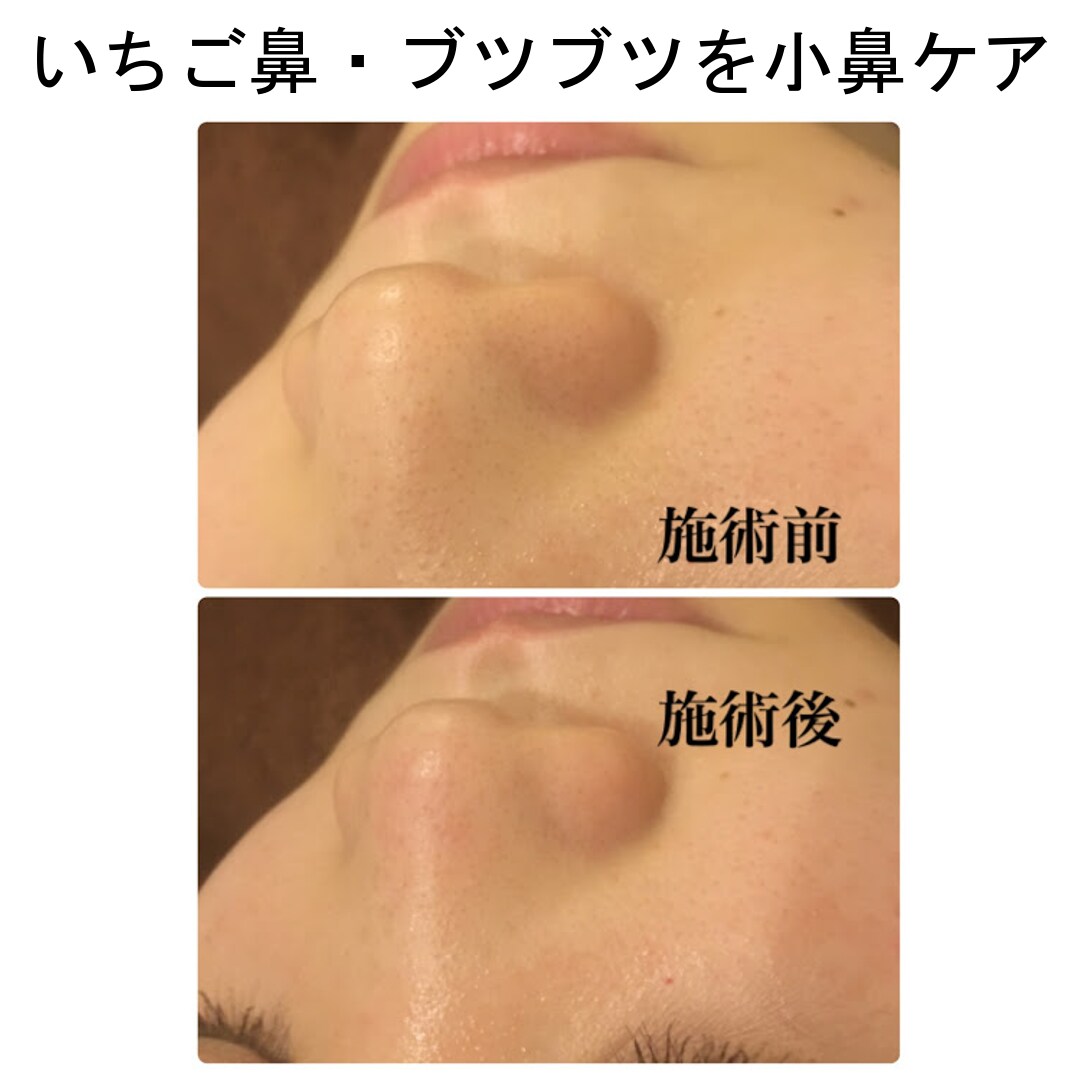 超敏感肌・アトピー肌のホームケをお教え致します ひとりひとりの生活に合わせたホームケアとスキンケアをご紹介 イメージ8
