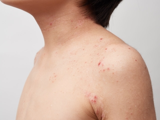 アレルギー克服体験からアトピーの治し方を提供します 薬を使わず、原因は何か。常識を疑い・食生活改善を提案します。 イメージ8