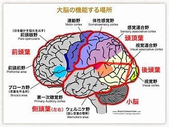 認知症良くなる？「認知症改善予法１０か条」教えます MCIは改善します。キーワードは脳の可塑性です。 イメージ2