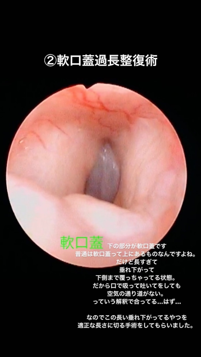 短頭種気道症候群についてご相談承ります 動物呼吸器科認定看護師が短頭種気道症候群についてご説明します イメージ4