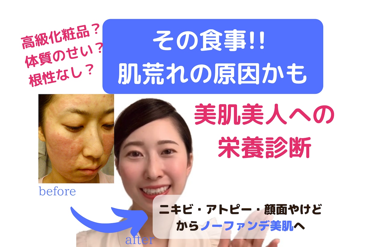 アトピー・ニキビ・敏感肌＊美肌への栄養診断をします 栄養不足が原因かも☆美容迷子から分子栄養学で美肌へ イメージ1