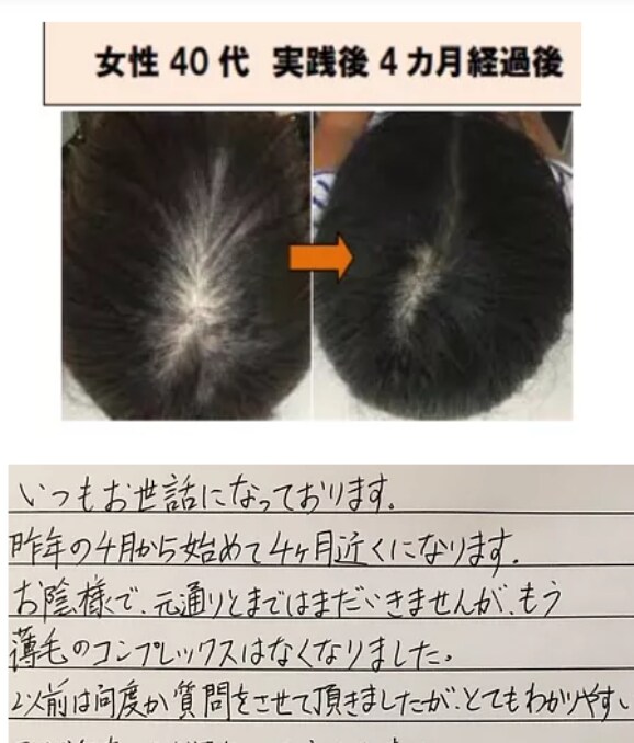 ミノキシジル無しでこの効果！写真のように改善します いつまでミノタブ、フィンペシアの副作用で消耗してるんですか？ イメージ4