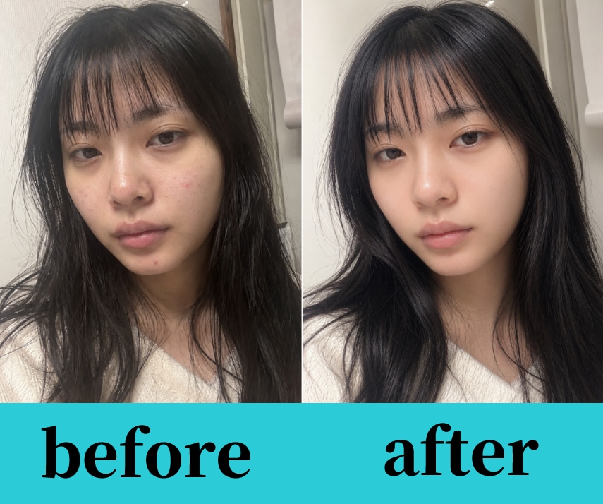 あなたの写真を自然に・盛れてる写真へレタッチします 数々の女性を美しくしたレタッチャーが盛れる写真に！ イメージ1