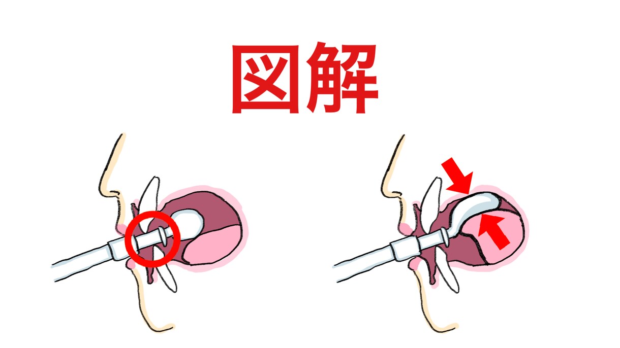 現役歯科衛生士がゆる可愛い医療イラストをお描きます パワポや院内の資料にゆるいイラストを入れて可愛さアップ！ イメージ10