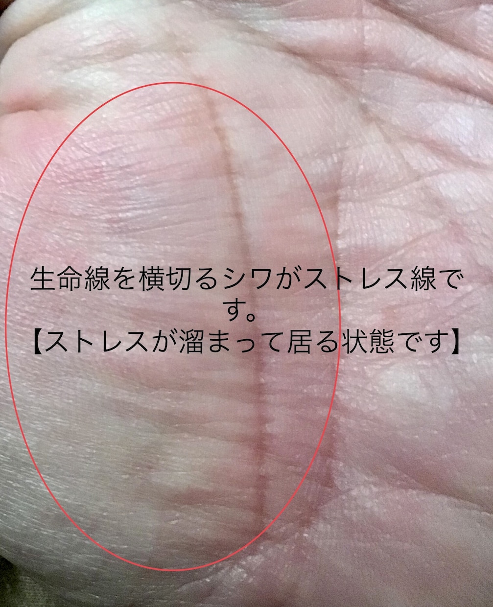観相35年15000人占ったプロが詳細鑑定します 右手から性格、金運、仕事運、恋愛運、子宝、健康運を占います。 イメージ9