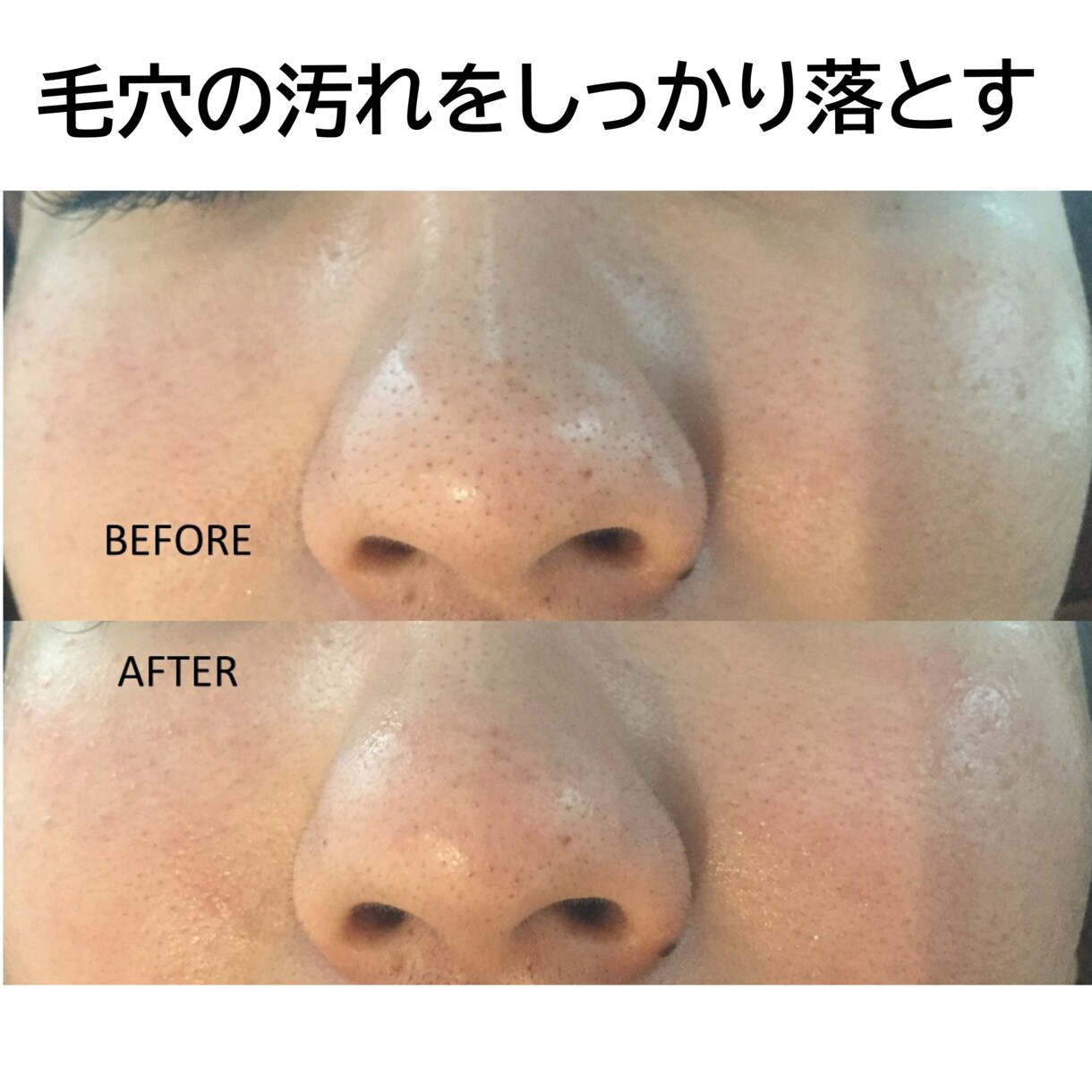 超敏感肌・アトピー肌のホームケをお教え致します ひとりひとりの生活に合わせたホームケアとスキンケアをご紹介 イメージ6