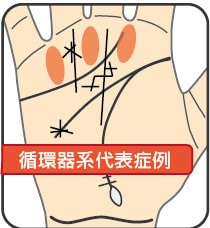 掌紋医学の手相診断で身体の弱い所をお伝えします 将来的疾患リスク、健康運を専門的な手相鑑定で簡単チェック イメージ1