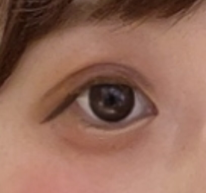 あなたの瞼にぴったりの二重にする方法を教えます テープか、のりか…どの方法がいいの？写真で診断できます！ イメージ1