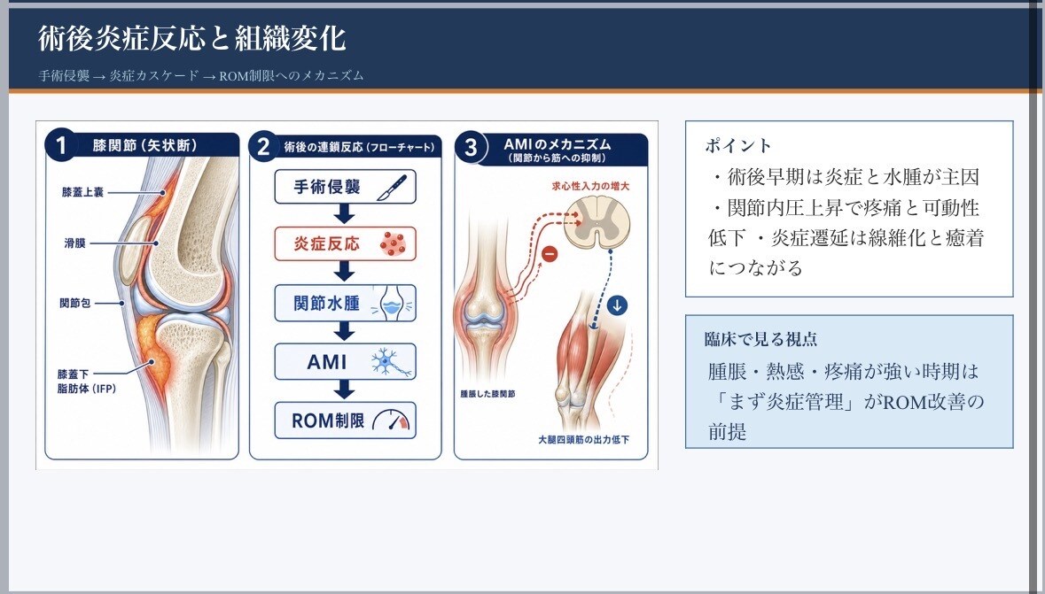 整形外科PT歴9年勉強会院内研修スライド作成します 整形外科理学療法士｜膝関節専門・勉強会講師 イメージ6