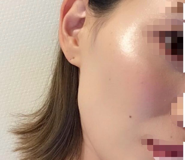 あなたのお肌悩みを改善するスキンケアを教えます 肌荒れ•お肌のお悩み改善！スキンケアアドバイス！ イメージ1