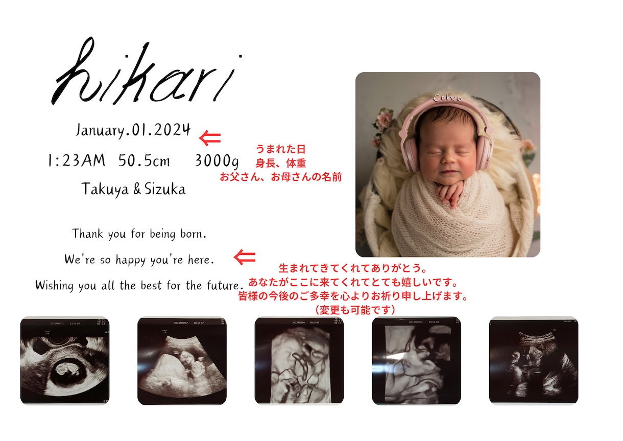 色褪せるエコー写真をずっと残るポスターにします エコー写真をずっと形に残るポスターにしませんか？ イメージ2