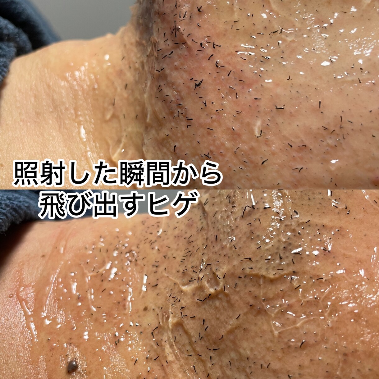 ヒゲ脱毛で結果を出せてないオーナー様救います 効果が出ない原因を徹底改善！1ヶ月で別人にできるサロンへ。 イメージ1
