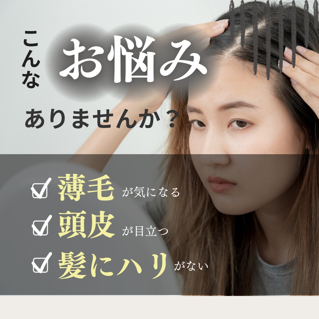 6月末迄の特別価格　　あなたの薄毛の原因解明します 年齢を理由に諦めない！10年後も生え続けられる髪にしましょう イメージ1