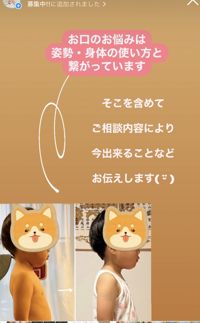 お口のお悩み(歯磨き.歯並び.離乳食)相談承ります ＊全身の発達＆姿勢から矯正なしのお口を育てる歯科衛生士が対応 イメージ6
