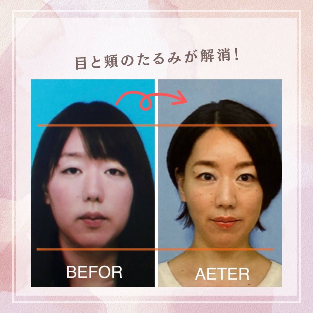 一生使える！セルフ美顔筋エクササイズを教えます 1日5分で若返り！お金をかけずにキレイになれてコスパ◎です！ イメージ2