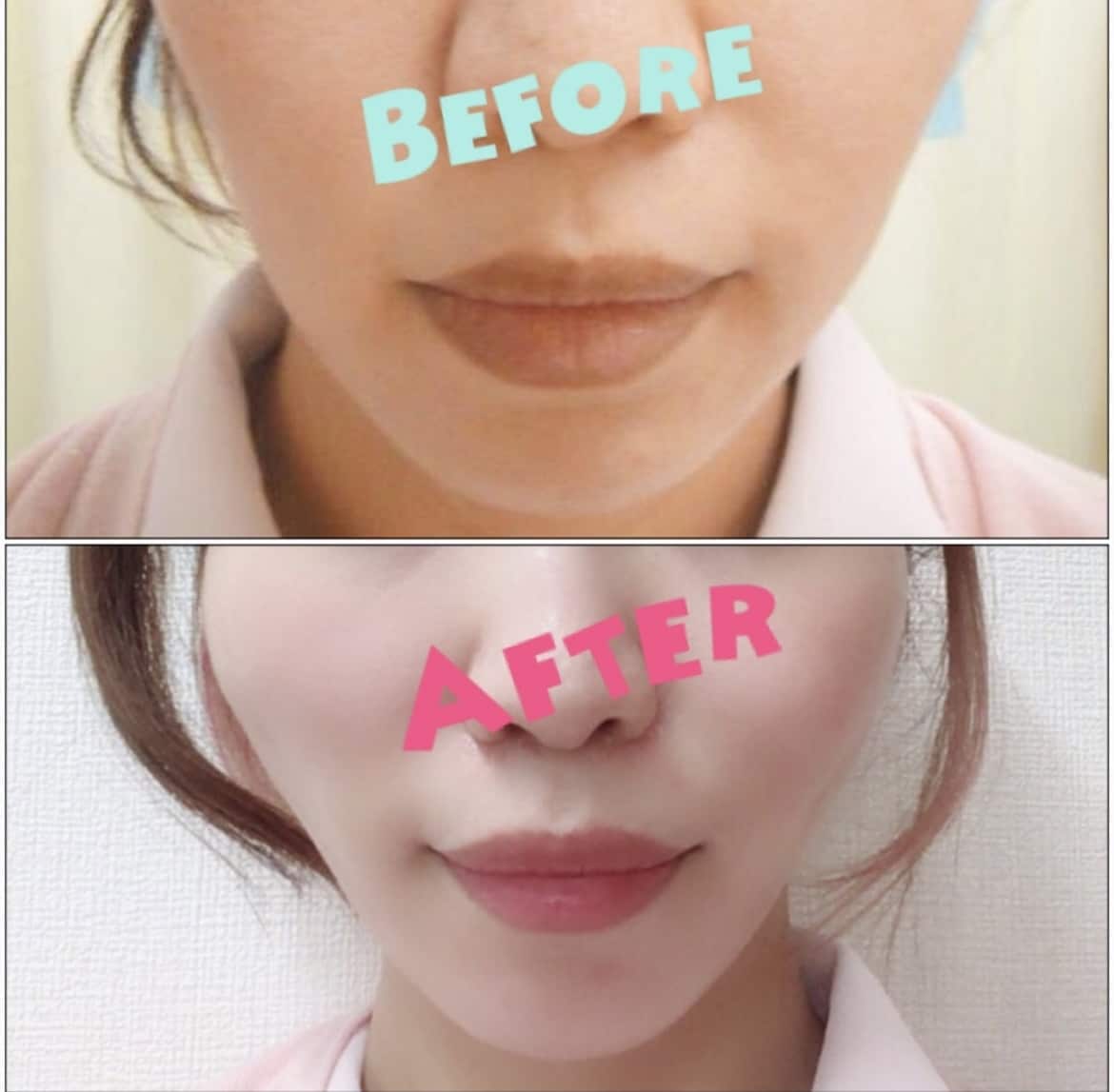 現役美容カウンセラーが本音の整形相談を承ります 利害目的が一切無い、一人一人に寄り添った治療をアドバイス イメージ2