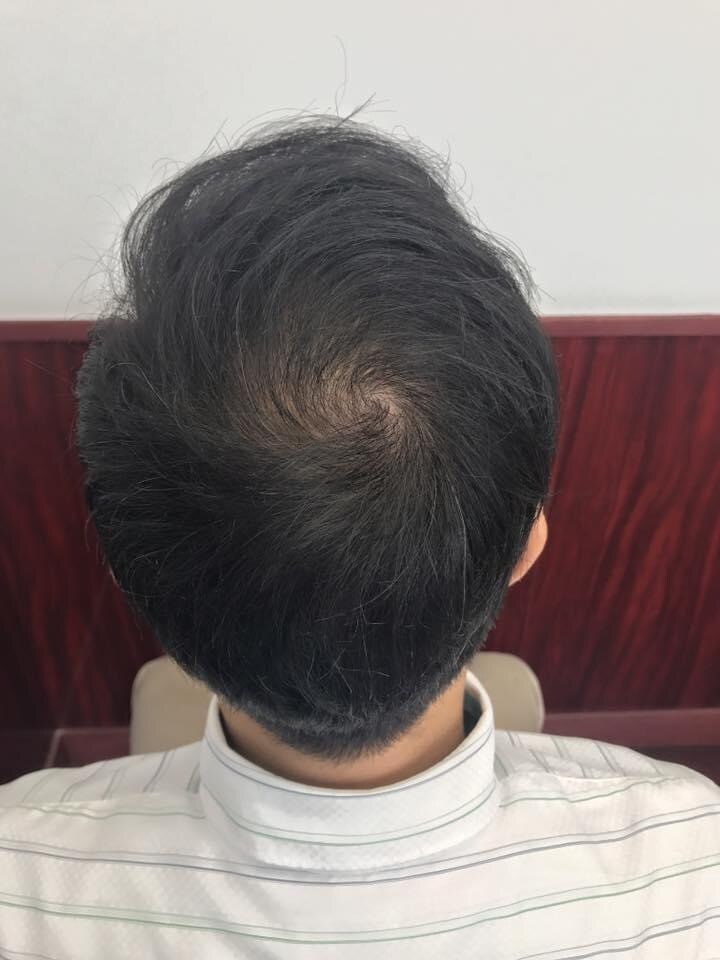 初回特価⭐︎育毛Only Oneアドバイスをします ＼先着30名様限定／自宅で育毛にコミット！最適なアドバイス イメージ5