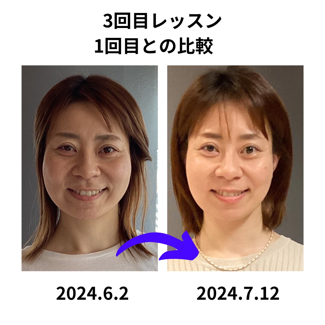 整形いらず！1日5分♡お顔の正しい筋トレ教えます 1日5分のセルフケアで整形いらず！自分で創る、理想の美顔♪ イメージ5