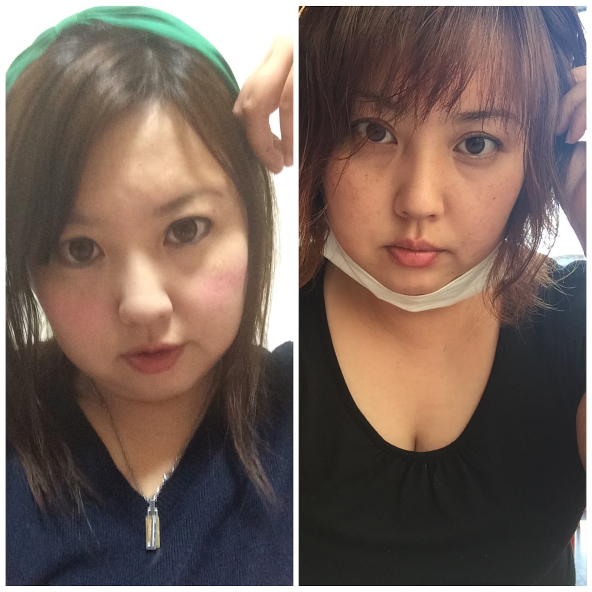 女性専門！美容整形をお考えの方私が相談に乗ります プチ整形、美容整形  を知りたい方へ。 イメージ2