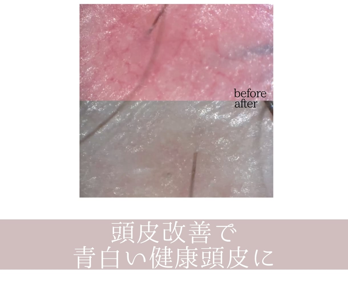 髪と頭皮にお悩みの方へ専門家が答えます 美容師免許保有・現役ヘッドスパニストの美容お悩み相談室 イメージ5