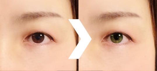 デジタルプチ整形で自然に美しく仕上げます！シミしわ消しで若返りも！ イメージ3