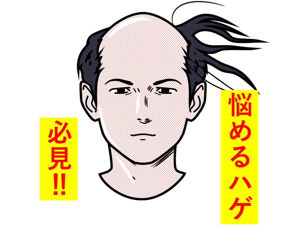 AGA（ハゲ）克服体験を教えます 私のリアル実体験を教えます!! イメージ1