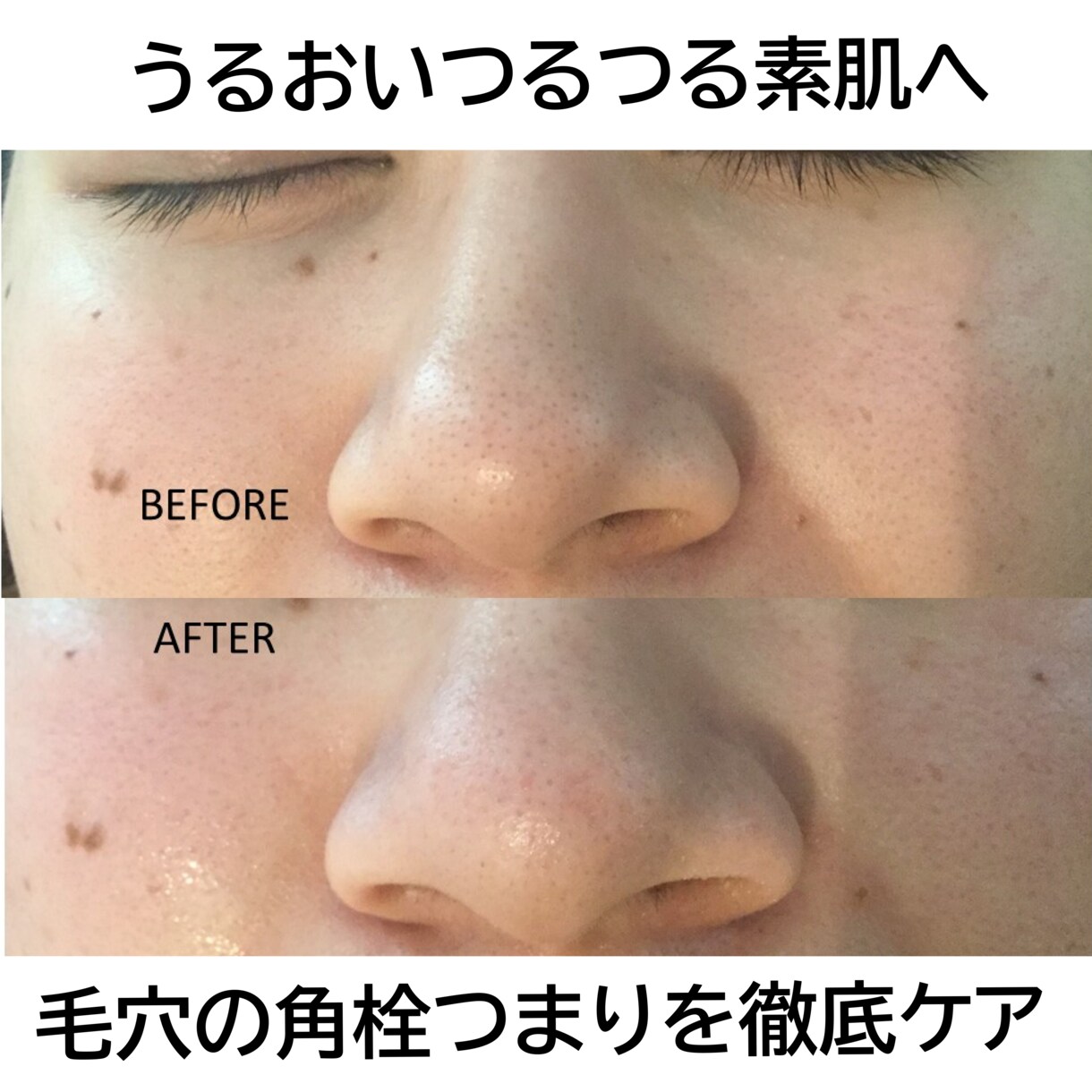 超敏感肌・アトピー肌のホームケをお教え致します ひとりひとりの生活に合わせたホームケアとスキンケアをご紹介 イメージ7