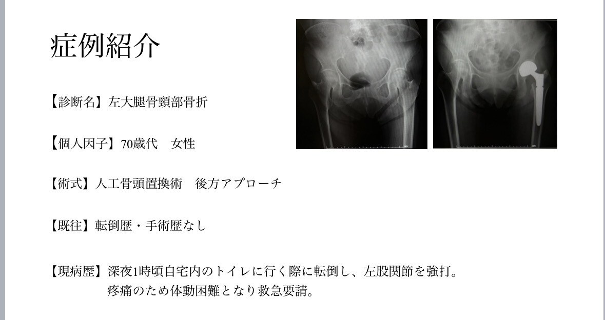 整形外科PTが学会・症例発表スライドを添削します 学会発表・症例発表を「伝わるスライド」にブラッシュアップ イメージ7