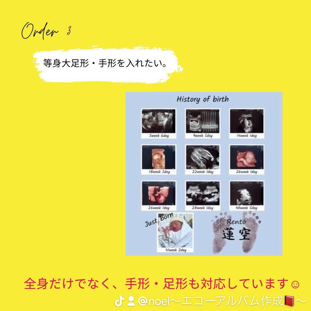 世界に一つだけのエコーアルバムを作ります お腹の中から始まる家族の物語を、永遠に残すお手伝いをします。 イメージ7