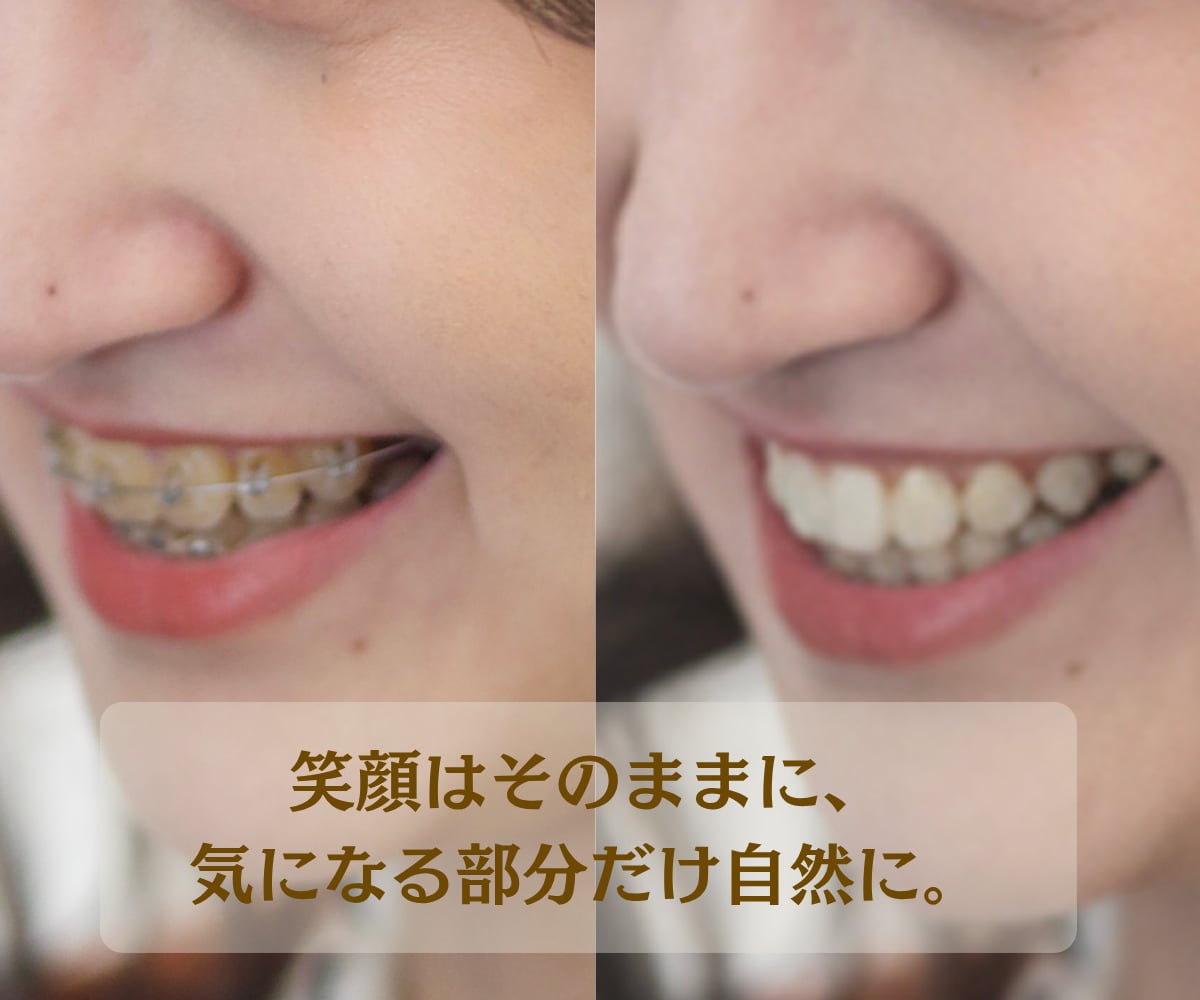 プロ品質で写真を美しく仕上げます 大切な写真を丁寧に、美しく仕上げます イメージ2